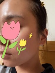 -北京米扬丽格医疗美容·联合丽格鼻整形中心