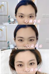 -久匠·纹眉纹绣半永久
