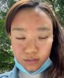 点击看大图 -ROYEA茹彦祛痘·问题肌肤修护中心
