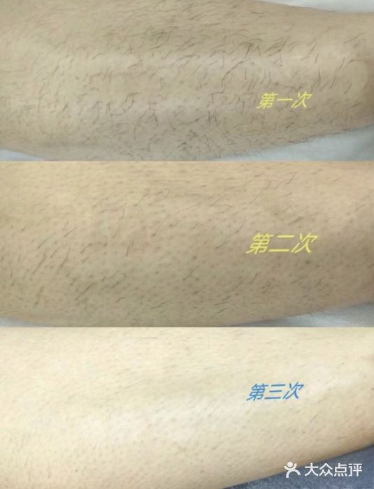 薇兰专业脱毛连锁机构(大望路店)图片