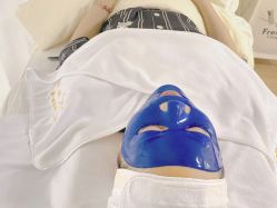 体验后-Younger Skin·科技氧肤中心