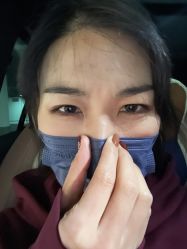 体验后-四川娇点医学美容医院