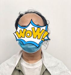 -发饰美男士增发补发假发定制店