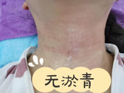 -新美荟医美·专注面部美学抗衰