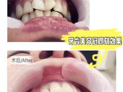 -团圆口腔·种植中心(锦江院区)