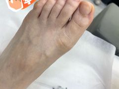 -郑远元专业修脚房·按摩·肉刺·灰指甲(汉中门大街店)