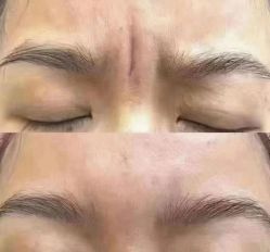 -睿明真达专业皮肤护理中心