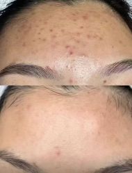 -Return·蕾特恩祛痘·皮肤管理中心