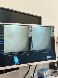 -苑苑vbeauty科技美容SPA
