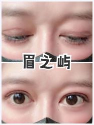 -美愈美肤MEIYU SKIN