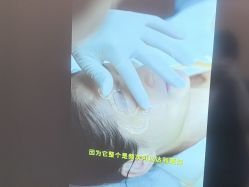 -More摩尔医美の注射线雕光电中心