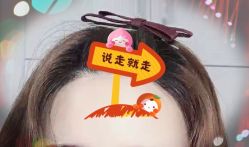 -大麦微针植发全国连锁