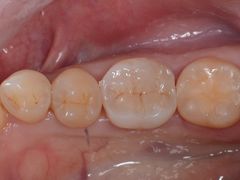 -新达口腔(华东理工大学店)