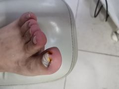 -新甲连锁灰指甲·甲沟炎·鸡眼(黑龙江路店)