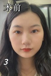 -素美医疗美容·西南眼鼻整形·修复基地