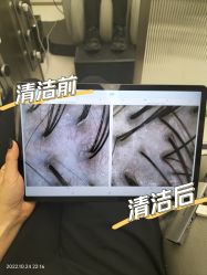 点击看大图 -润复丝·泽发防脱头皮管理