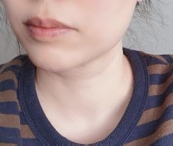 体验前-北京爱育华医院-医疗美容科