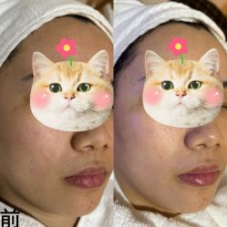 点击看大图 -栖SPA·ONDA ·美芙炫·海菲秀科技美肤中心