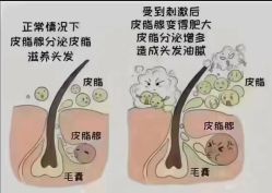 -诗碧曼养发