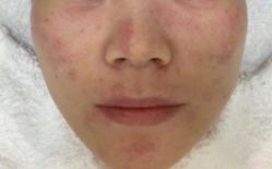 -上海漾颜医疗美容