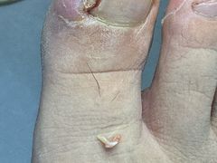 -世龙世家甲沟炎·灰指甲·嵌甲矫正·修脚(武侯区双楠店)