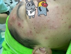 -荟草堂专业痘肌皮肤管理