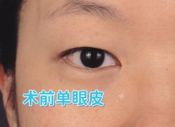 -联合丽格·张菡丽格医疗美容