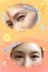 体验前-上海星和医疗美容