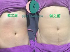 -万达广场(梁溪店)