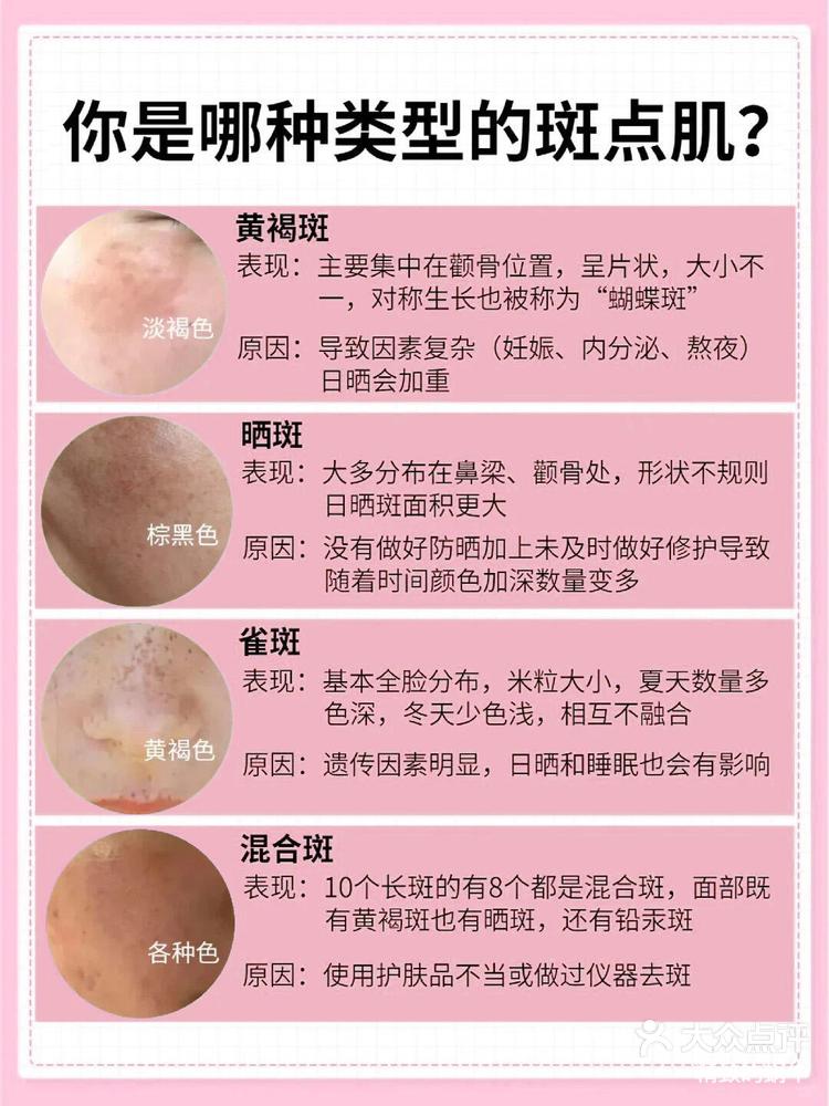 面部斑的对应图图片