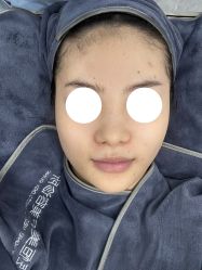 体验后-深圳医恒美医疗美容