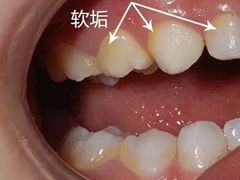 -团圆口腔·种植中心(锦江院区)