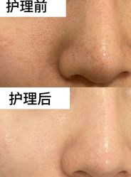 -SKIN79皮肤管理中心