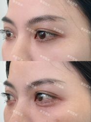 -杭州米兰柏羽医疗美容医院