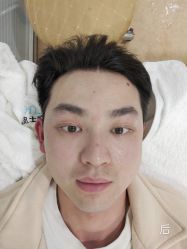 -痘院长·祛痘·皮肤管理