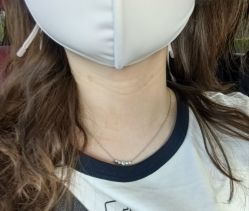体验后-苏州维多利亚美容医院