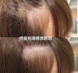 -OnHair造型