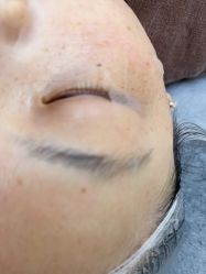 -长沙雅美医疗美容医院