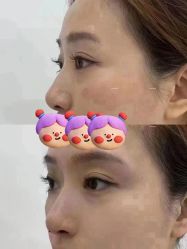 -杭州米兰柏羽医疗美容医院