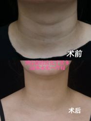 -上海漾颜医疗美容