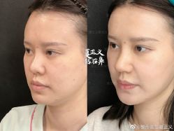 -北京米扬丽格医疗美容·联合丽格鼻整形中心