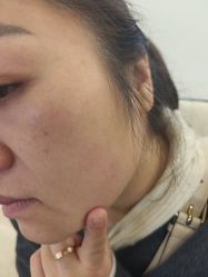 -长沙雅美医疗美容医院
