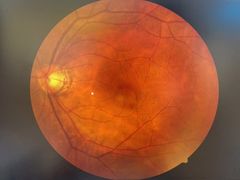 -宝岛眼镜(苏州浒关店)