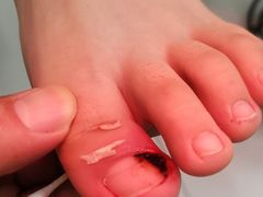 -新甲连锁灰指甲·甲沟炎·鸡眼(黑龙江路店)