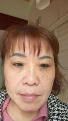 -天津健丽·去眼袋医疗美容机构