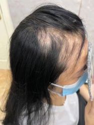 -唐风采假发补发定制