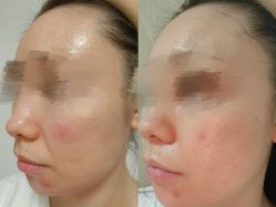 -彼家美创·量肤定制修护管理