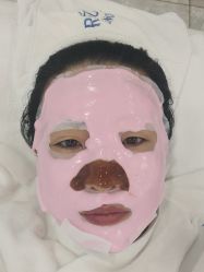 -蕾特恩专业祛痘国际连锁