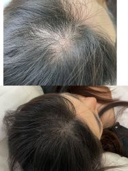 -变美丽半永久纹眉连锁·机器野生眉•洗眉