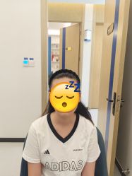 -大麦微针植发全国连锁